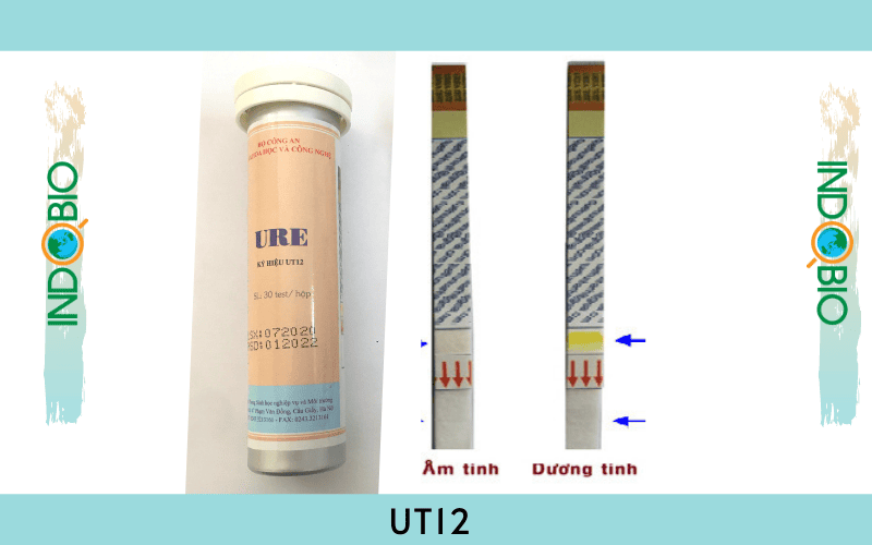 bộ test ure trong thủy hải sản UT12, bộ kit test của Bộ Công An